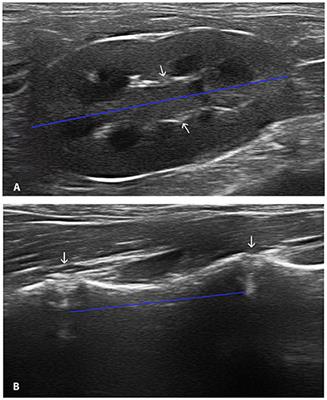 Ultrasonographic assessment of the renal size using a kidney length to vertebral body length ratio in cats